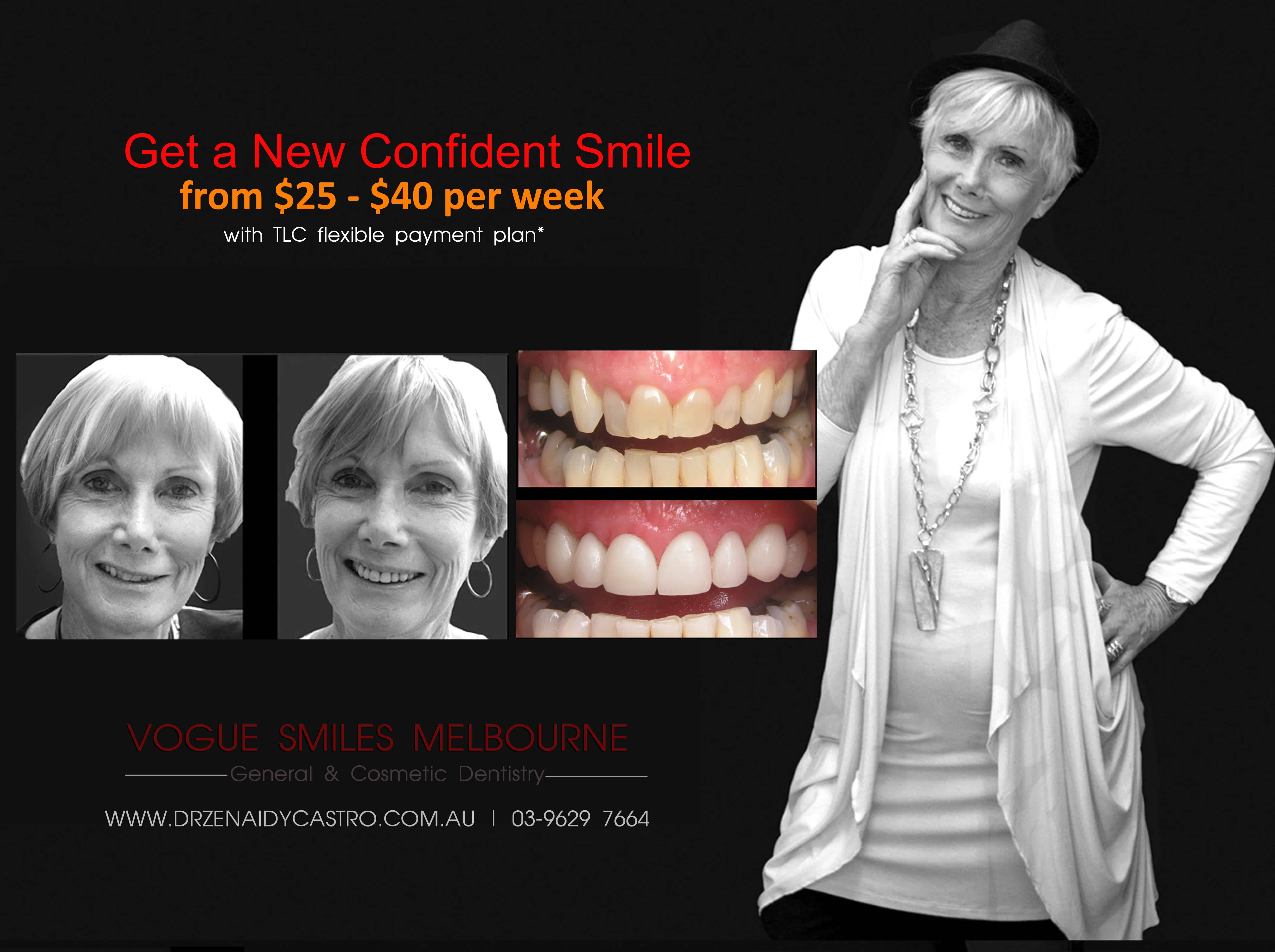 Dental Facelift Melbourne