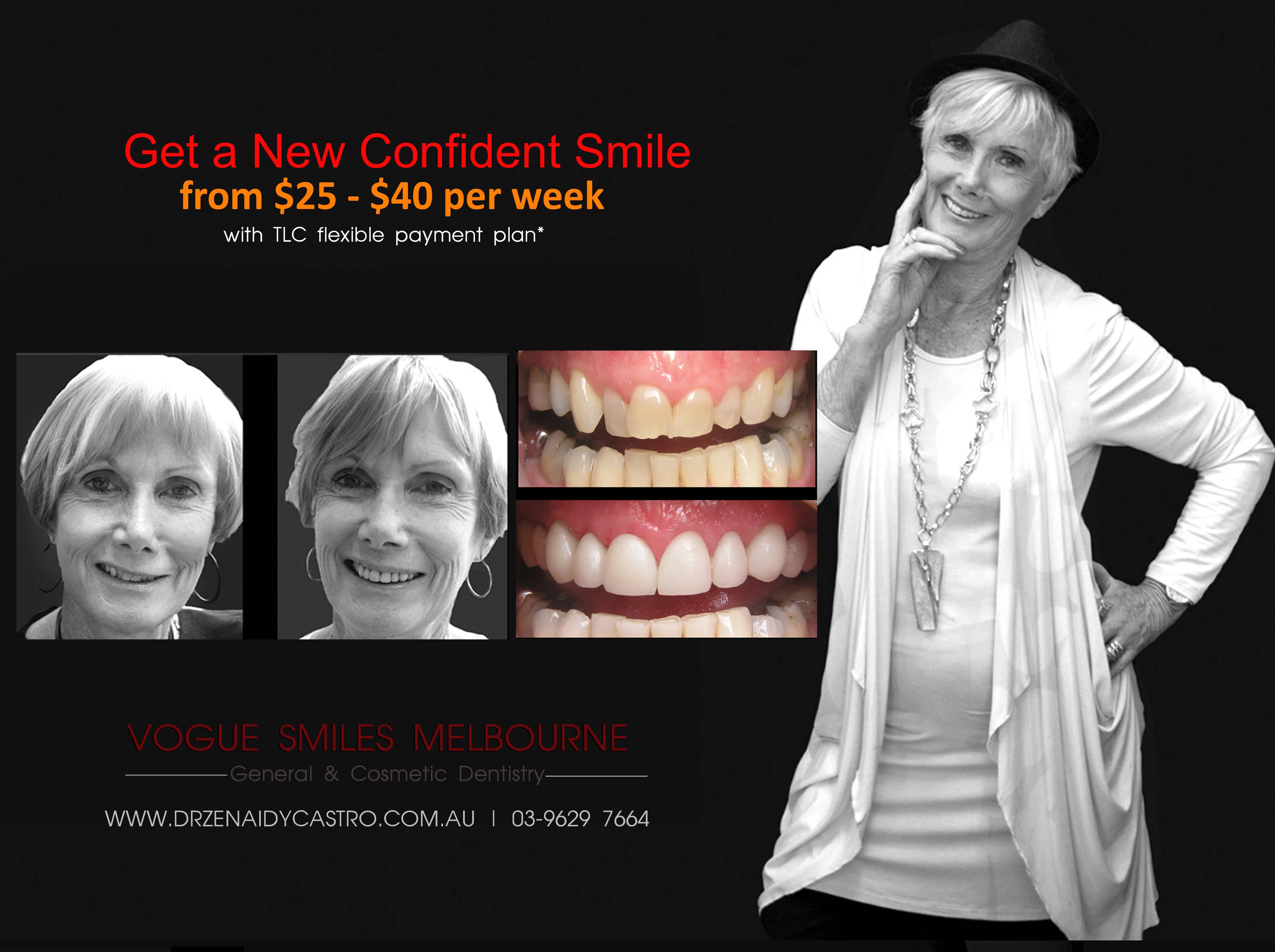 Non-surgical facelift procedure with Dental Veneers Melbourne CBD -Anti-aging expert Melbourne CBD, Non-Surgical & Minimally Invasive Facial and Smile Rejuvenation Melbourne