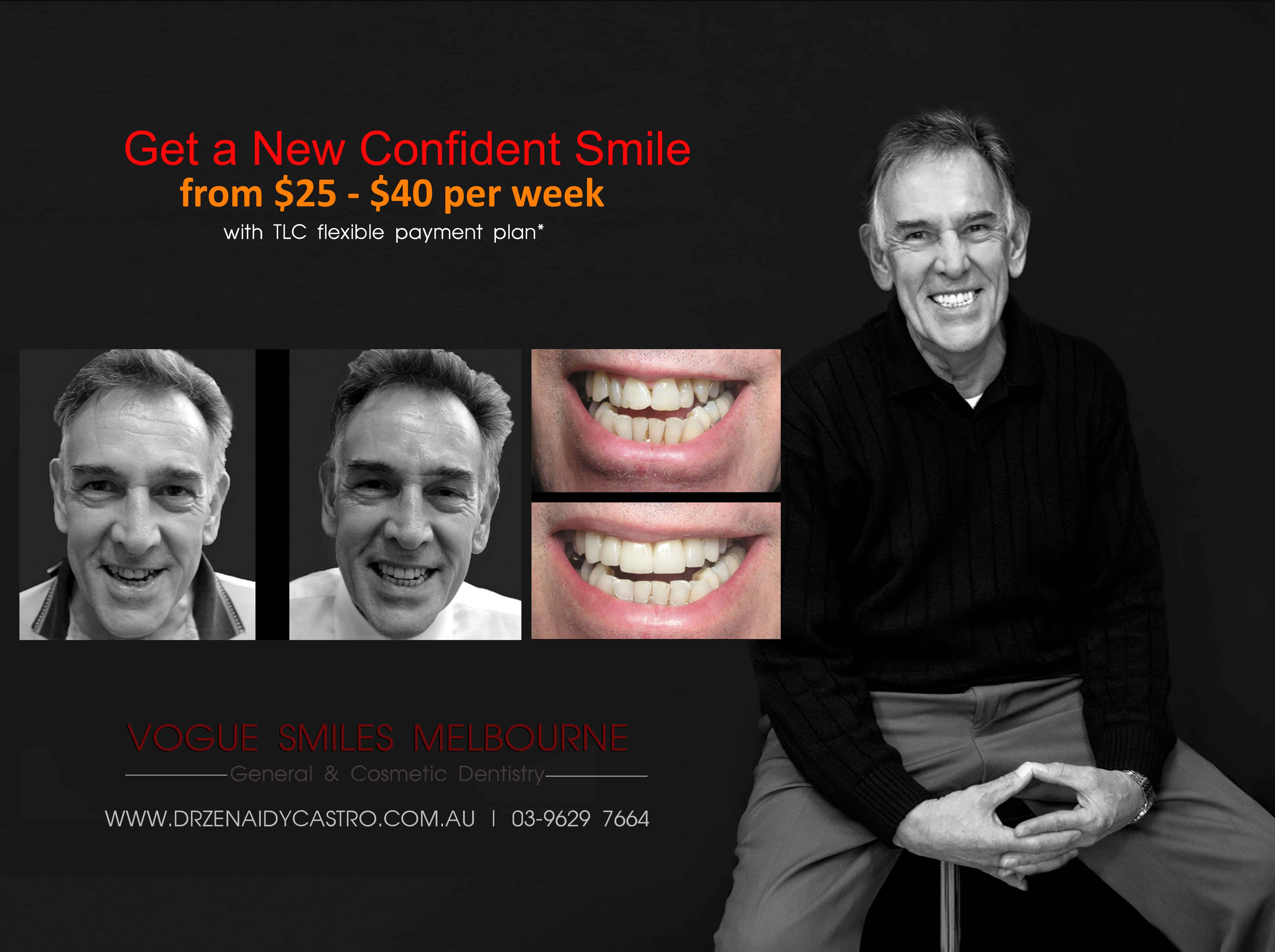 Full Dental Reconstruction Melbourne- Smile Rehabilitation & Makeover Melbourne CBD Victoria Australia