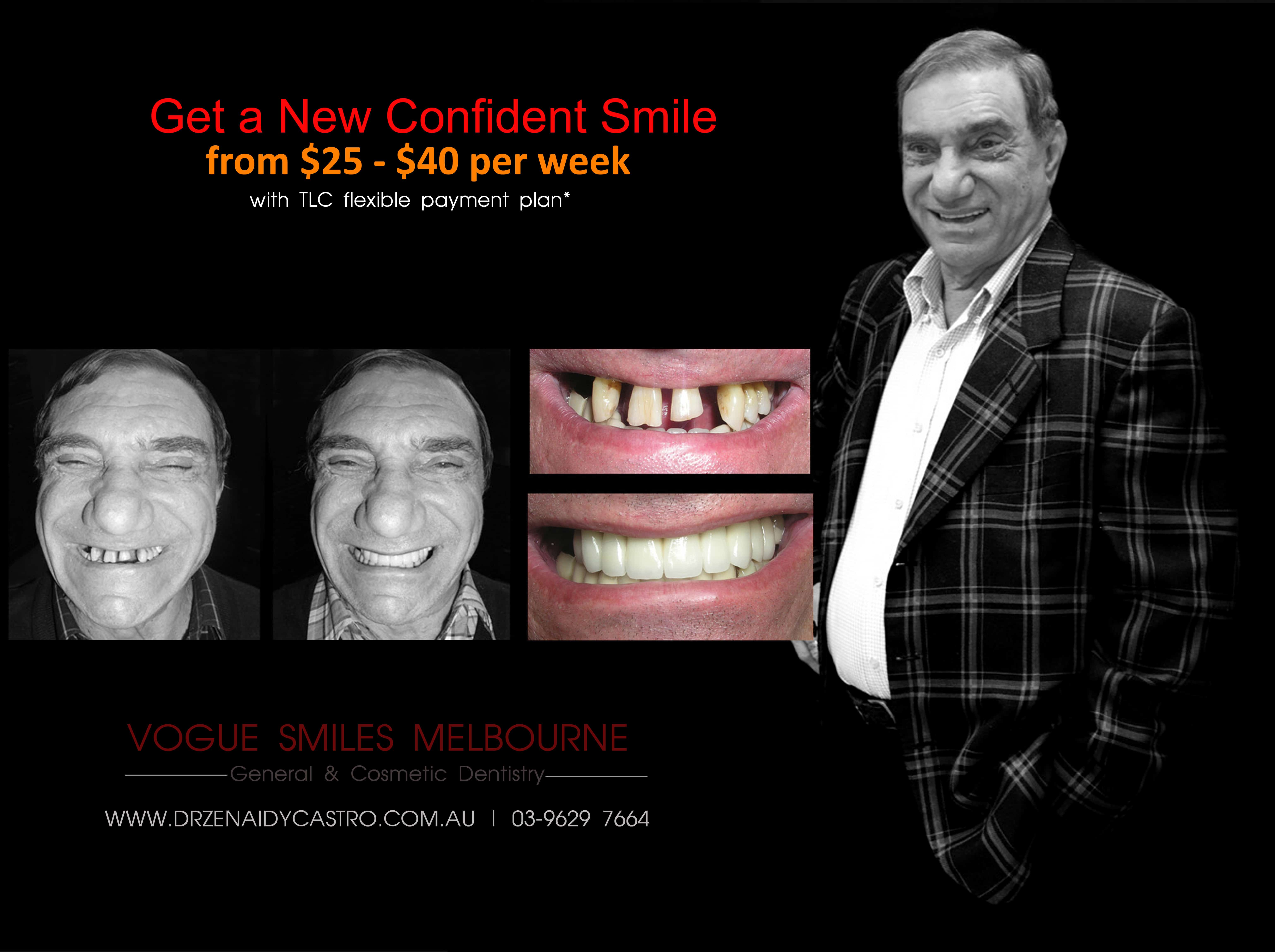 Non-surgical facelift procedure with Dental Veneers Melbourne CBD -Anti-aging expert Melbourne CBD, Non-Surgical & Minimally Invasive Facial and Smile Rejuvenation Melbourne