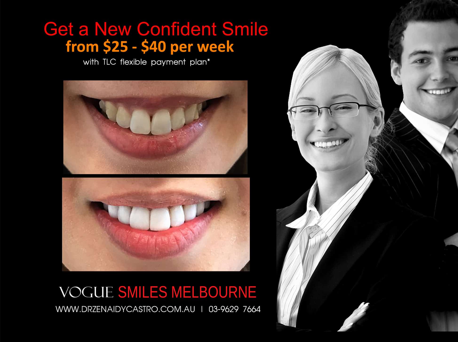 Porcelain veneers with No Grinding Down of Teeth, No-Prep, prepless Dental Veneers Melbourne CBD Best Cosmetic Porcelain Veneer dentist