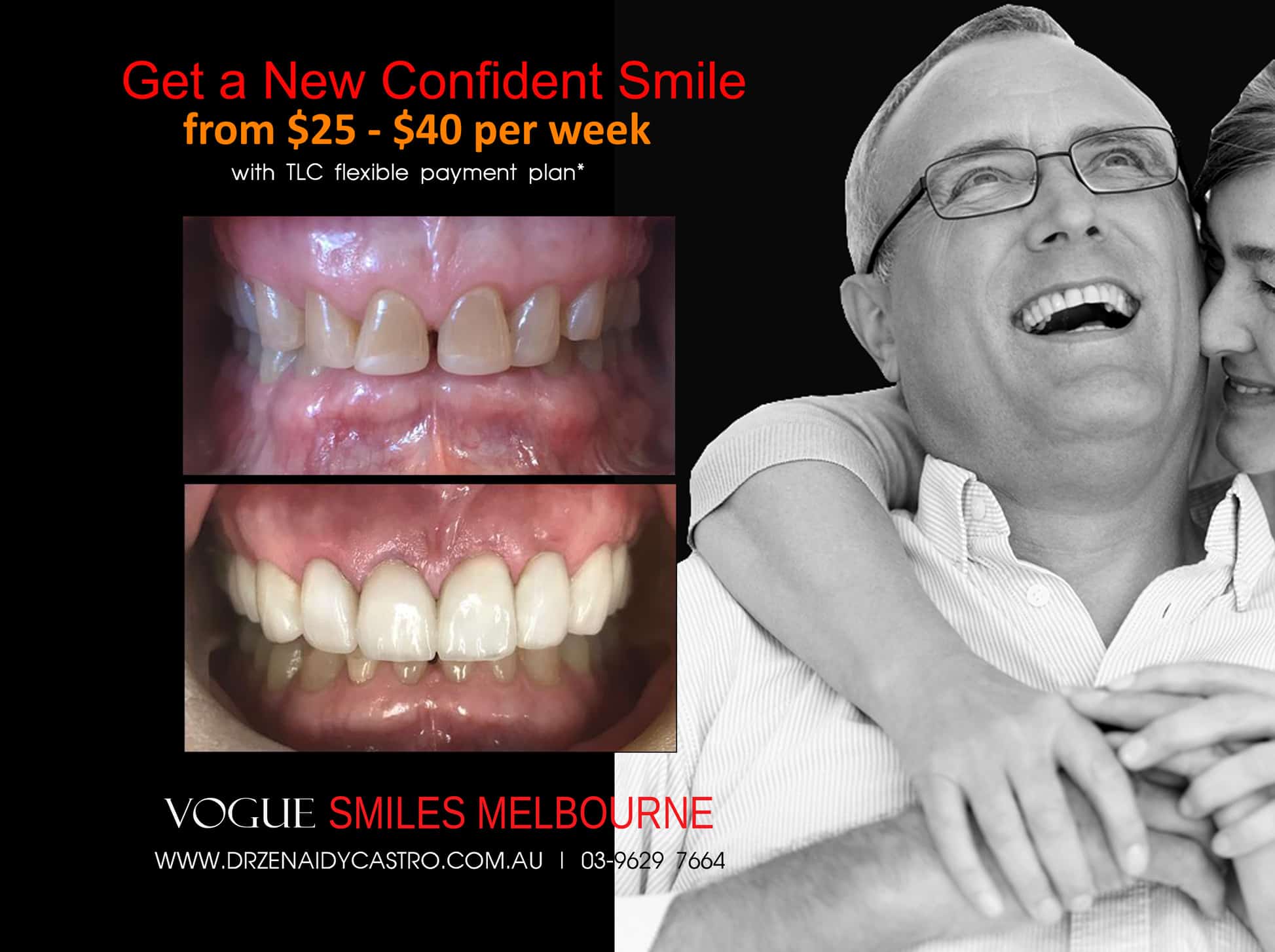 Full Mouth Reconstruction Melbourne