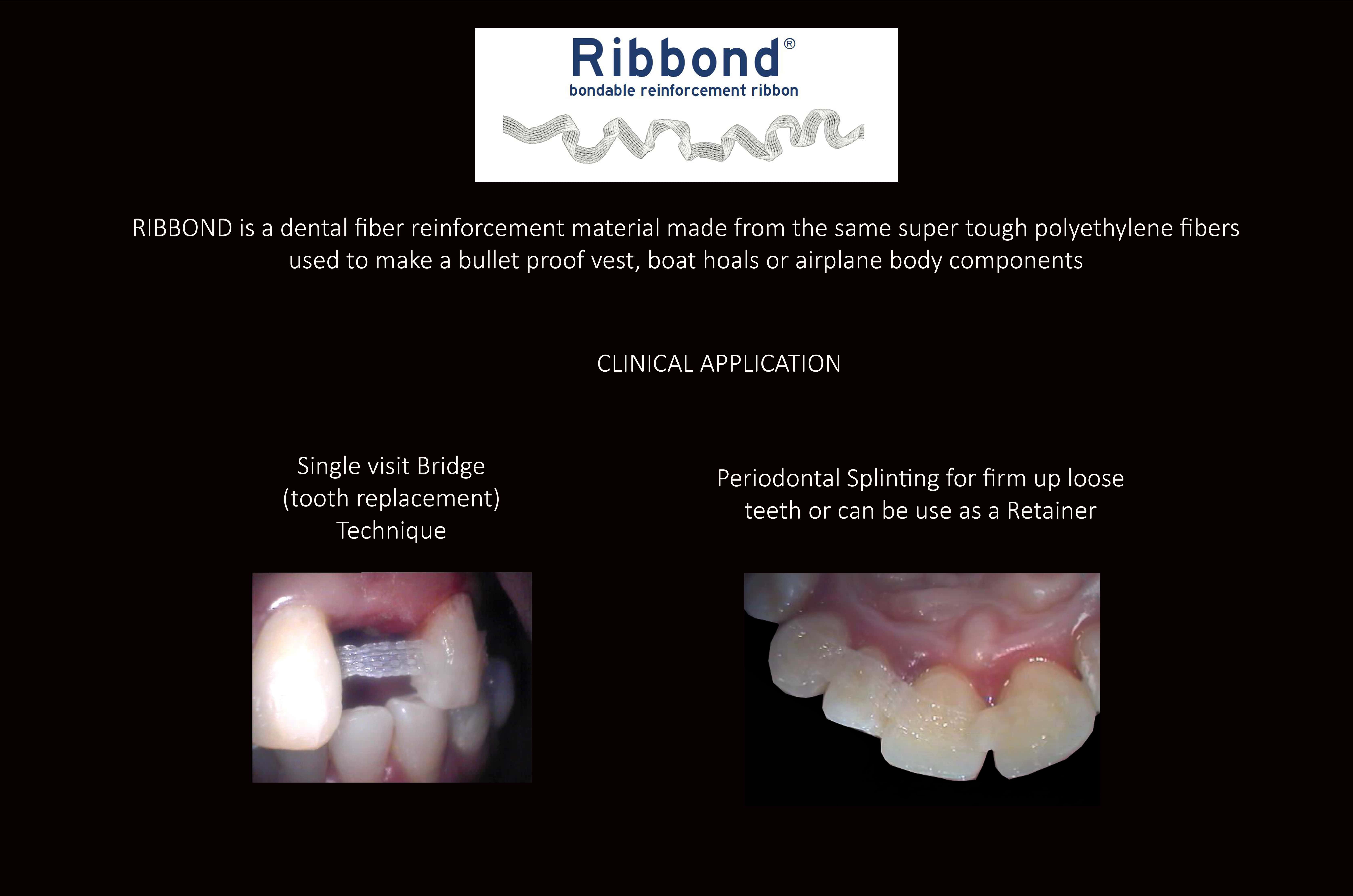 Replace Teeth Instantly - Affordable Same Day Smile Solution Melbourne -Intermediate smile Makeover Solution