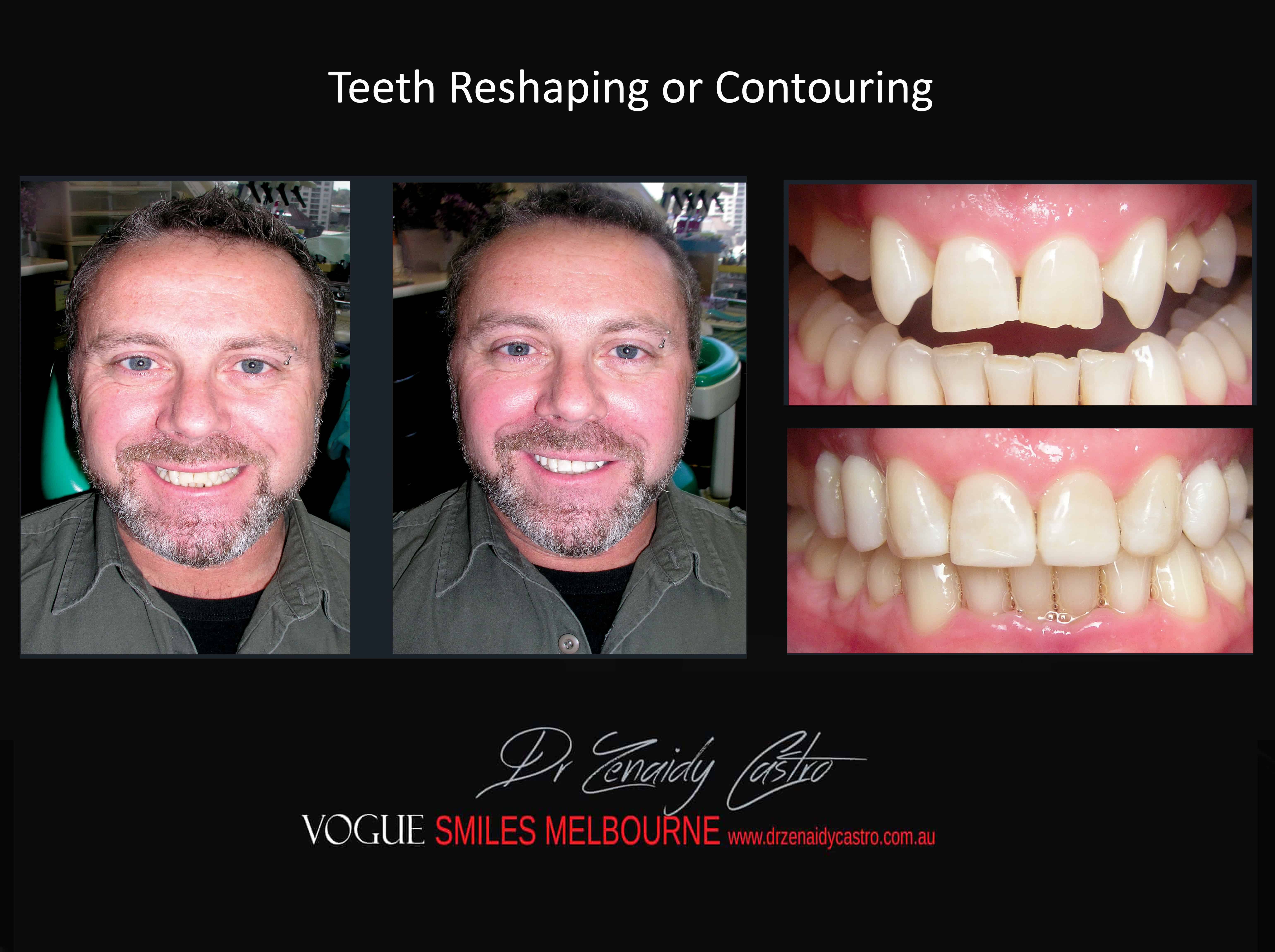 Cosmetic Dentistry Procedures and Treatments Melbourne CBD - Best Cosmetic Dentists in Melbourne, VIC -leading Australian Cosmetic Dentist