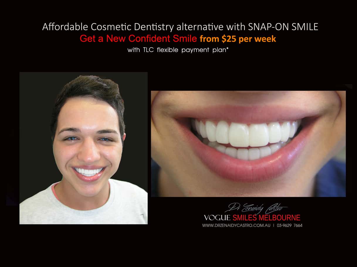 Smile Makeover Procedures Melbourne CBD Victoria Australia - Top Cosmetic Dentist Melbourne CBD - Dr Zenaidy Castro - VOGUE SMILES MELBOURNE