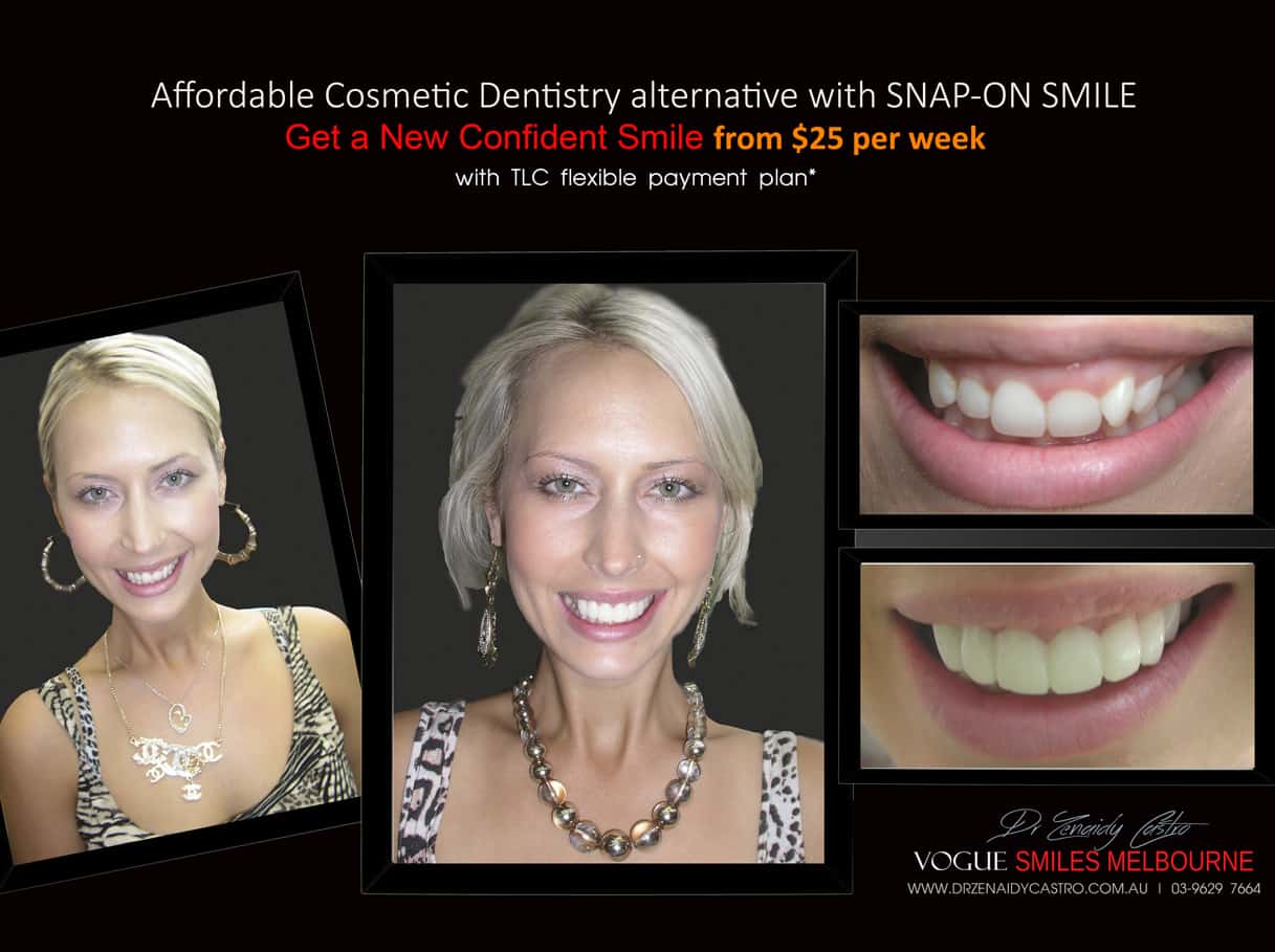 Snap on Smile Melbourne Australia | Affordable Cosmetic Dentistry Melbourne CBD