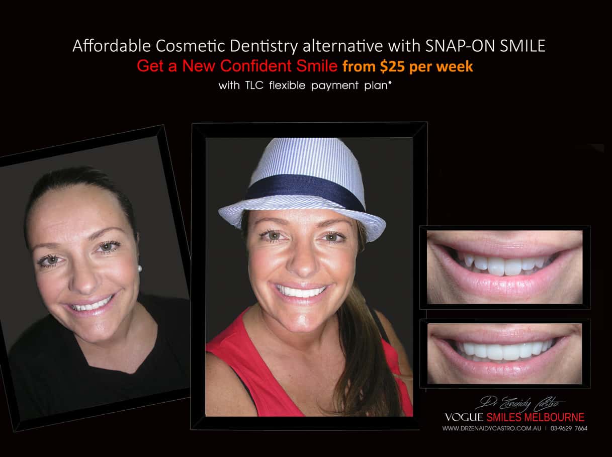 Snap on Smile Melbourne Australia | Affordable Cosmetic Dentistry Melbourne CBD