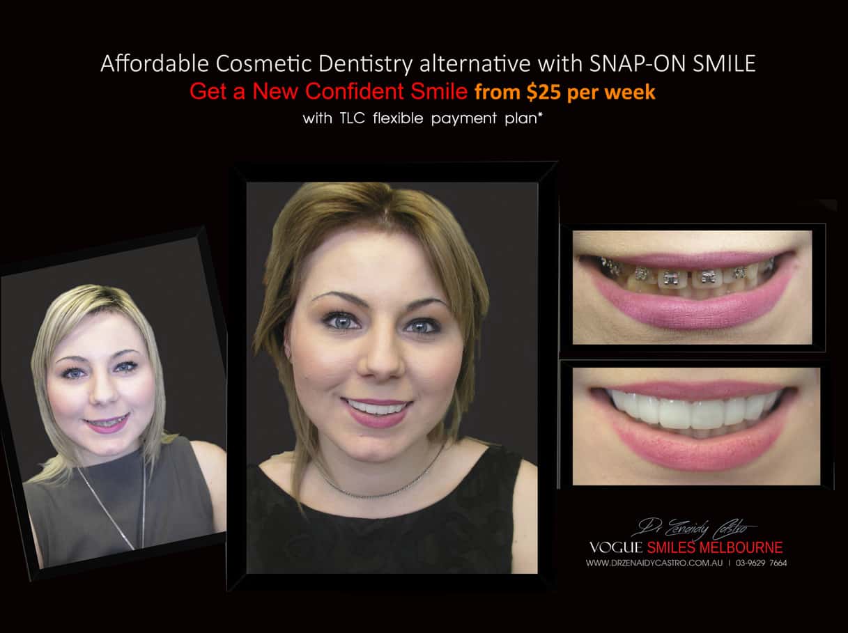 Snap on Smile Melbourne Australia | Affordable Cosmetic Dentistry Melbourne CBD