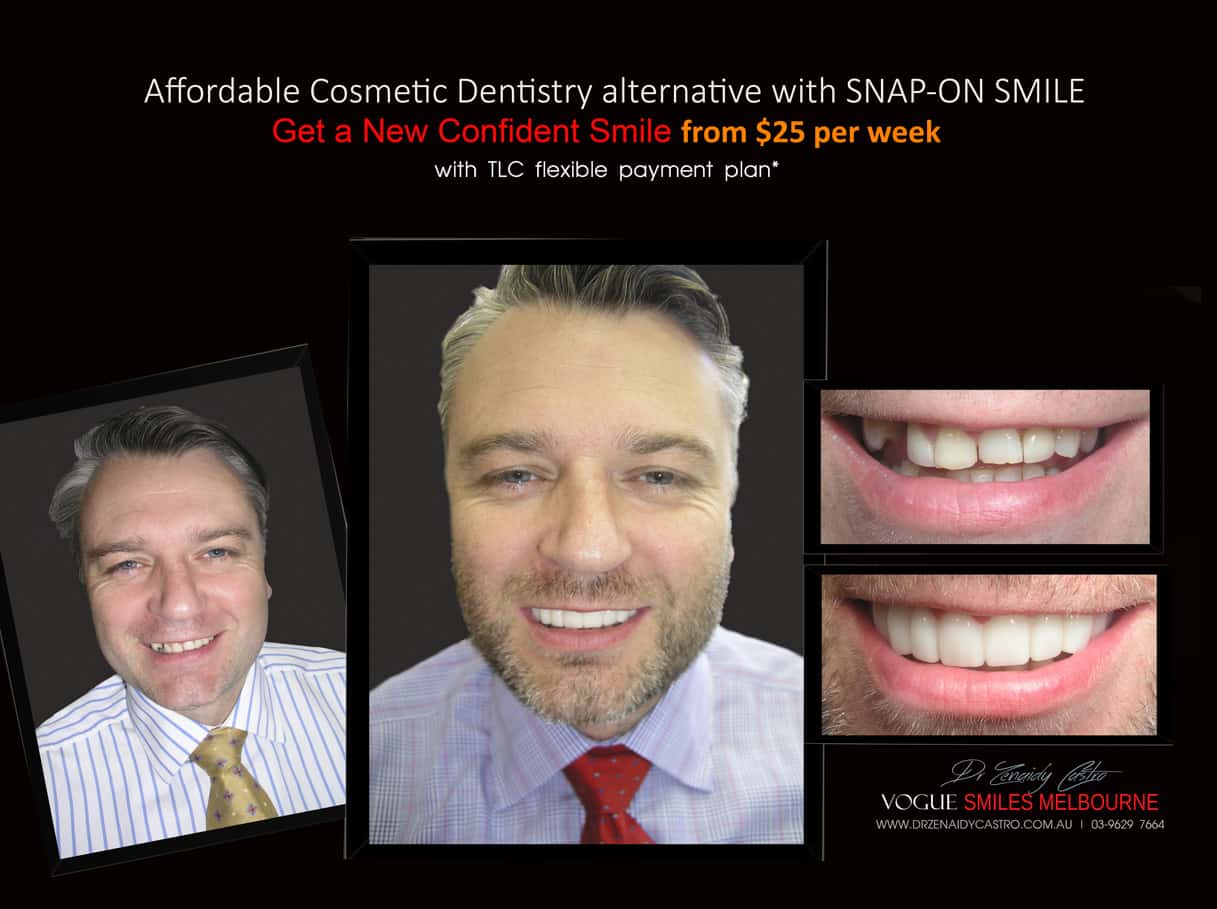 Snap on Smile Melbourne Australia | Affordable Cosmetic Dentistry Melbourne CBD