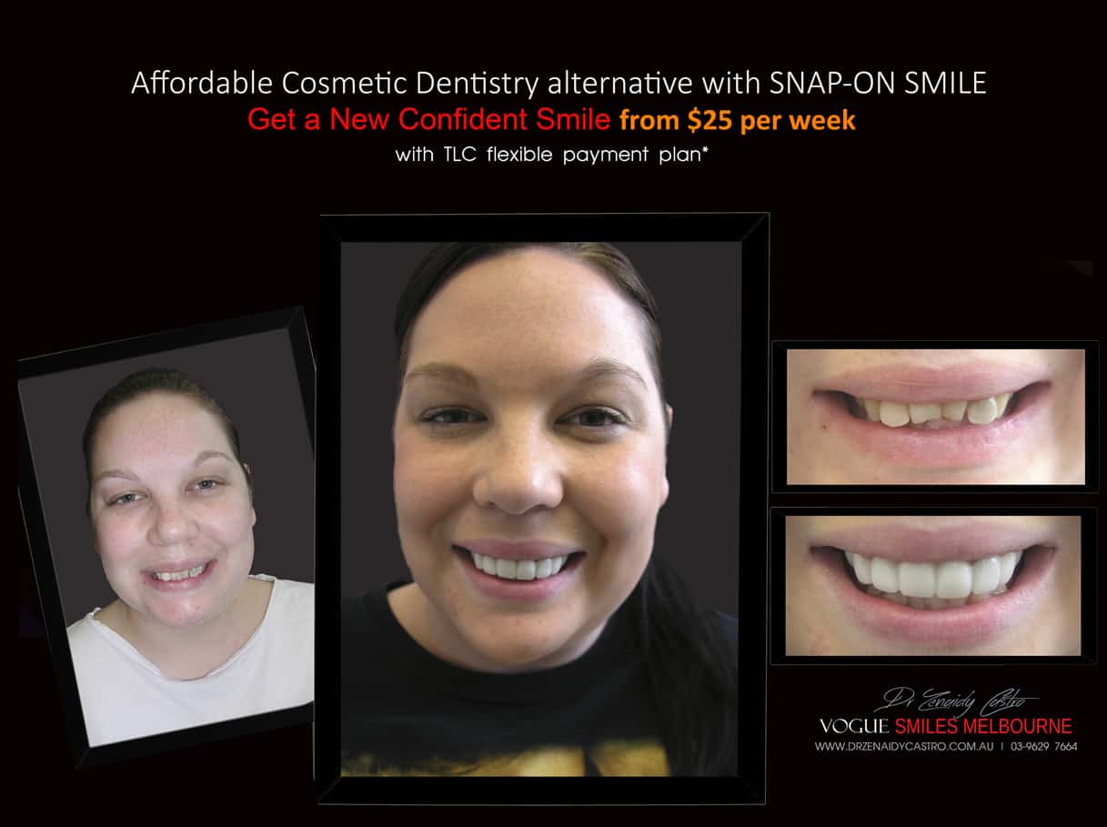 Most Affordable Way To Improve Your Smile Melbourne- CHEAPEST COSMETIC DENTISTRY SMILE MAKEOVER OPTION MELBOURNE DENTIST -Affordable Ways to Fix Your Smile and Boost Your Confidence