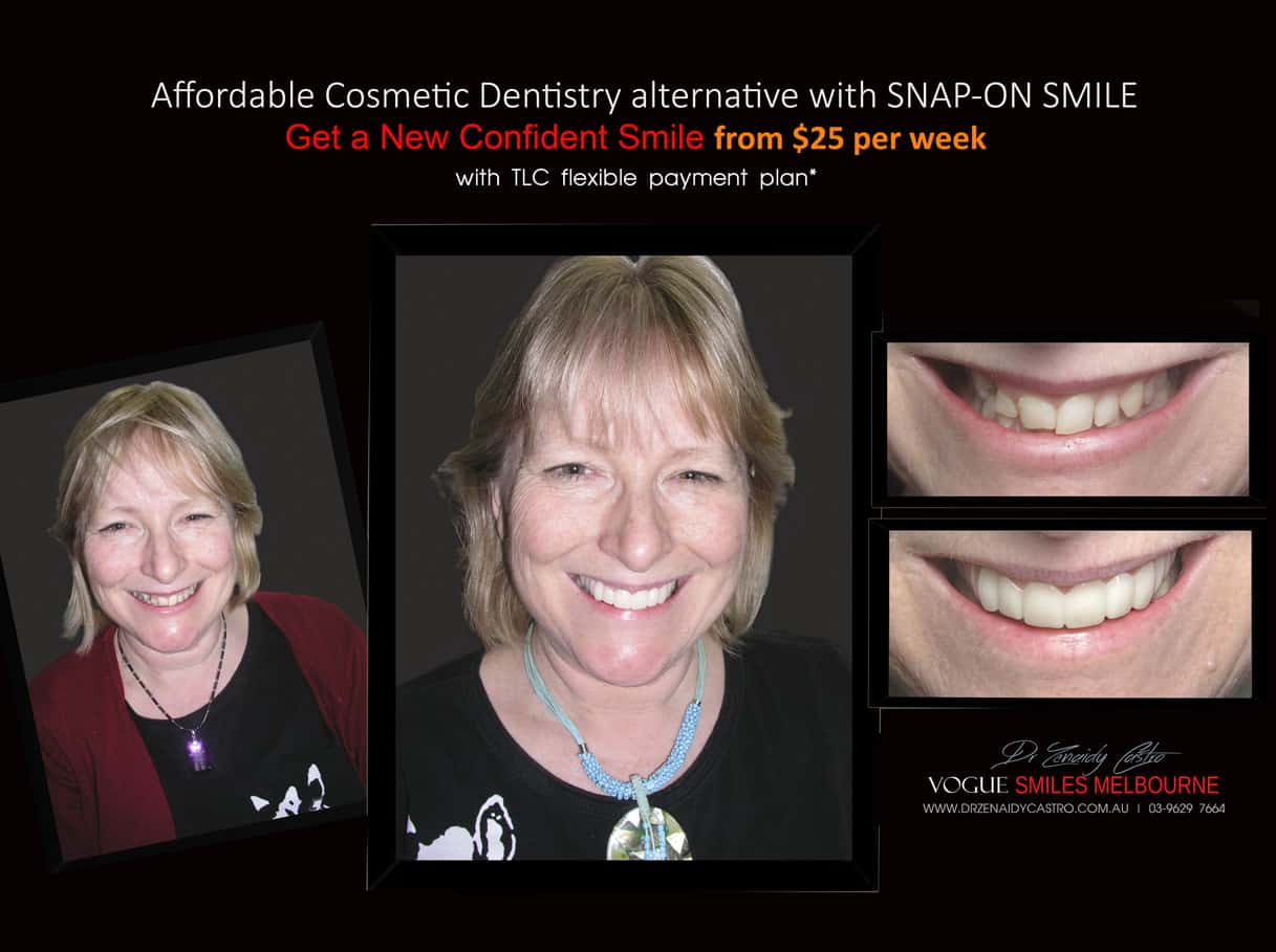 Most Affordable Way To Improve Your Smile Melbourne- CHEAPEST COSMETIC DENTISTRY SMILE MAKEOVER OPTION MELBOURNE DENTIST -Affordable Ways to Fix Your Smile and Boost Your Confidence