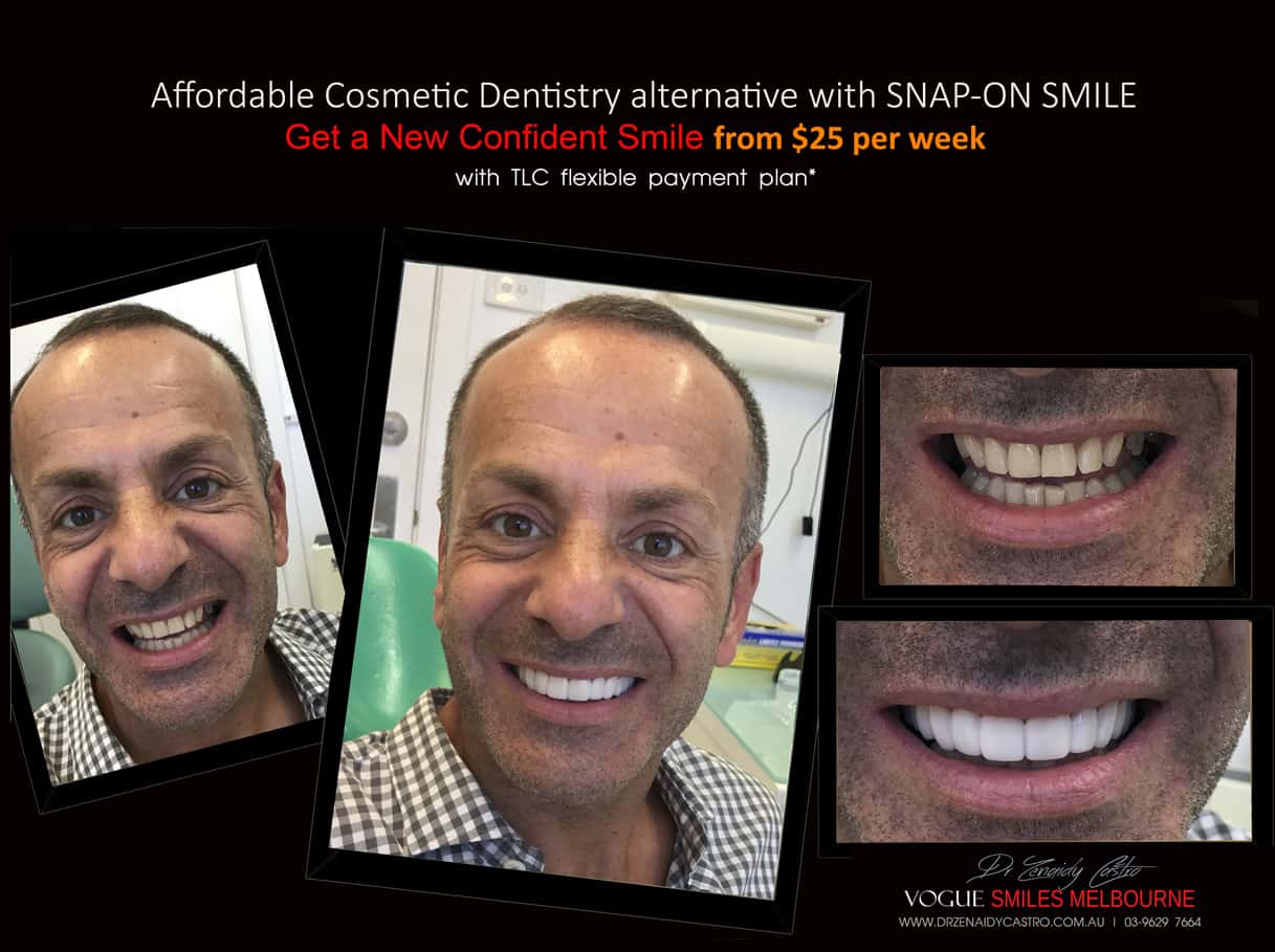 Anti-Aging Smile Rejuvenation Melbourne CBD- Cosmetic Dental Facelift Melbourne - look 10 years younger -Common Anti-Aging Treatments & Cosmetic Procedures -Non-surgical anti-ageing treatments