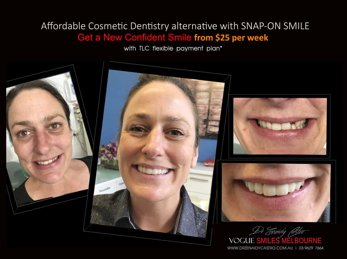 Most Affordable Way To Improve Your Smile Melbourne- CHEAPEST COSMETIC DENTISTRY SMILE MAKEOVER OPTION MELBOURNE DENTIST -Affordable Ways to Fix Your Smile and Boost Your Confidence