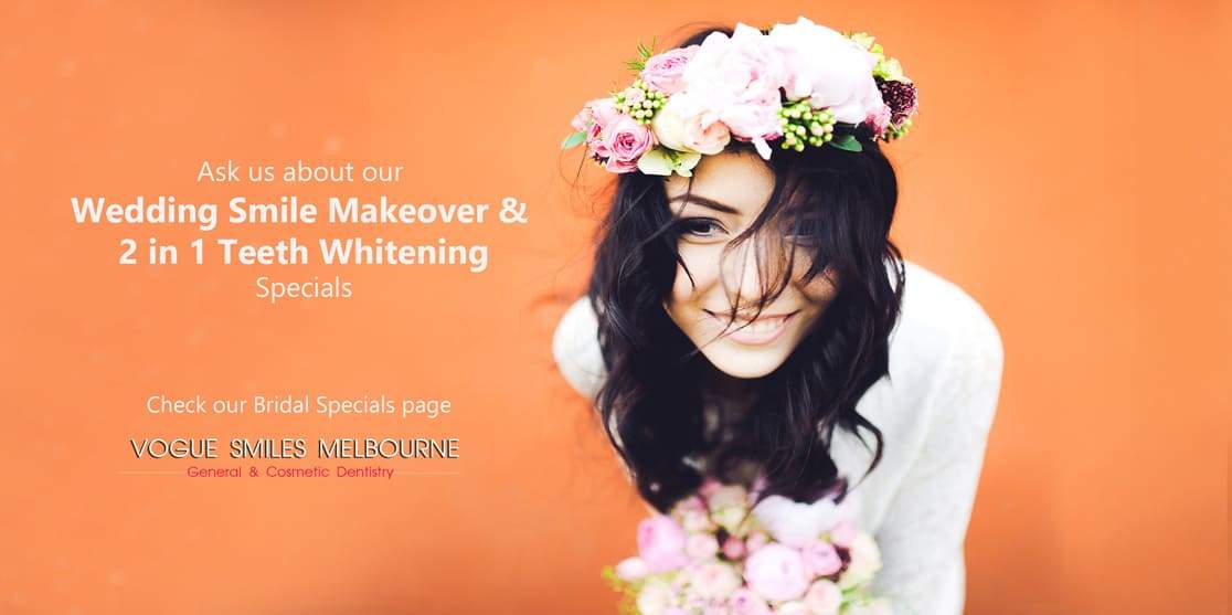 Wedding Smile Makeover Specials and Packages in Melbourne | Cosmetic Dentistry Bride and Groom BRIDAL wedding package deals | cheap wedding packages Melbourne