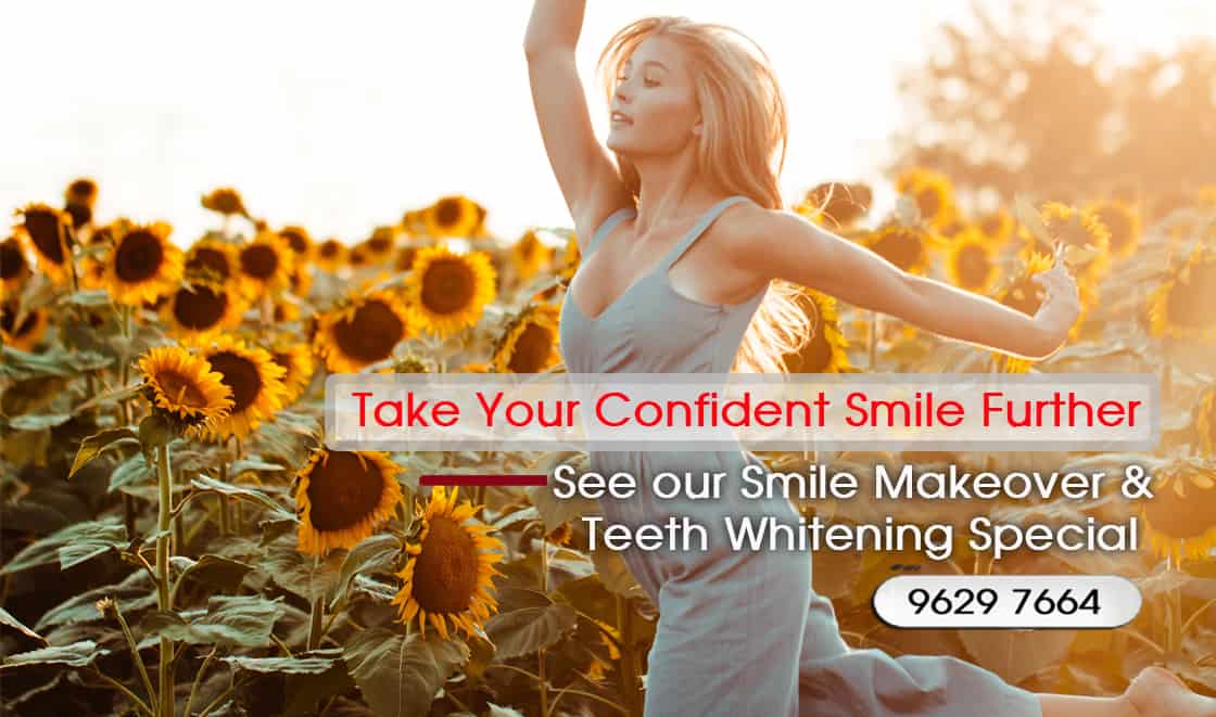 Teeth Whitening Melbourne - Teeth Whitening Specials and Packages Melbourne CBD - tooth bleaching