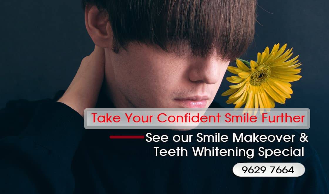 Most Affordable Way to Improve Your Smile and boost your Confidence
