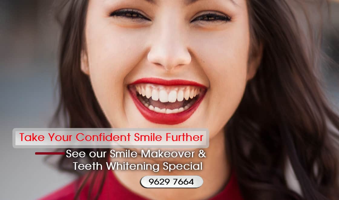 Dental Check-up and Teeth Cleaning Melbourne