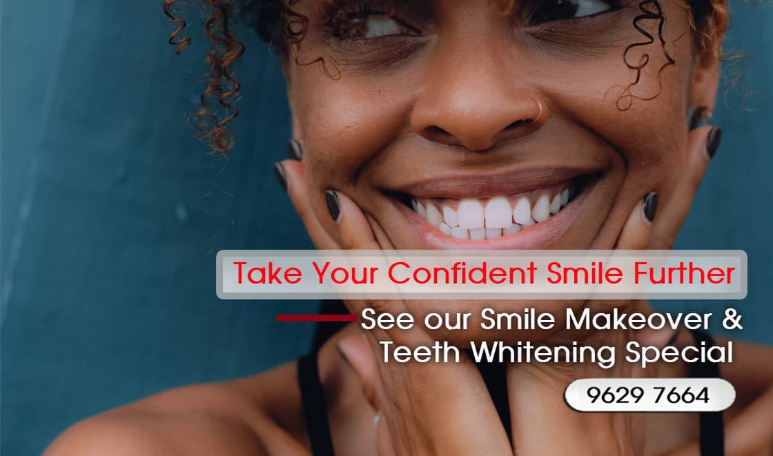 Tooth Bonding For Gaps and Spacing Between Your Front Teeth Melbourne CBD Victoria Australia - Cosmetic Dental expert Melbourne
