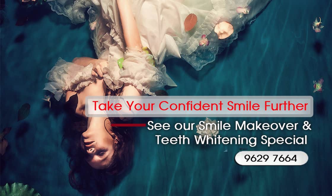 Dental Bonding Melbourne CBD - Affordable Cosmetic Dentistry Melbourne