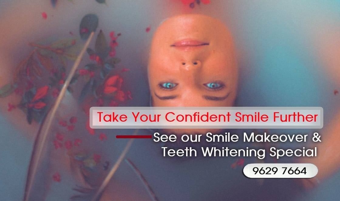 Cheaper alternative to Dental Implants, All-on 4 implants & Bridges in replacing missing teeth with Snap-on Smile Melbourne CBD- Cheap affordable Cosmetic Dentistry in Melbourne Victoria Australia