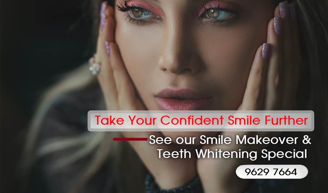 Anti-Aging Dentistry with Porcelain Veneers Melbourne, Anti-Aging Dentofacial Lift Melbourne, Solutions for Aging Teeth Melbourne
