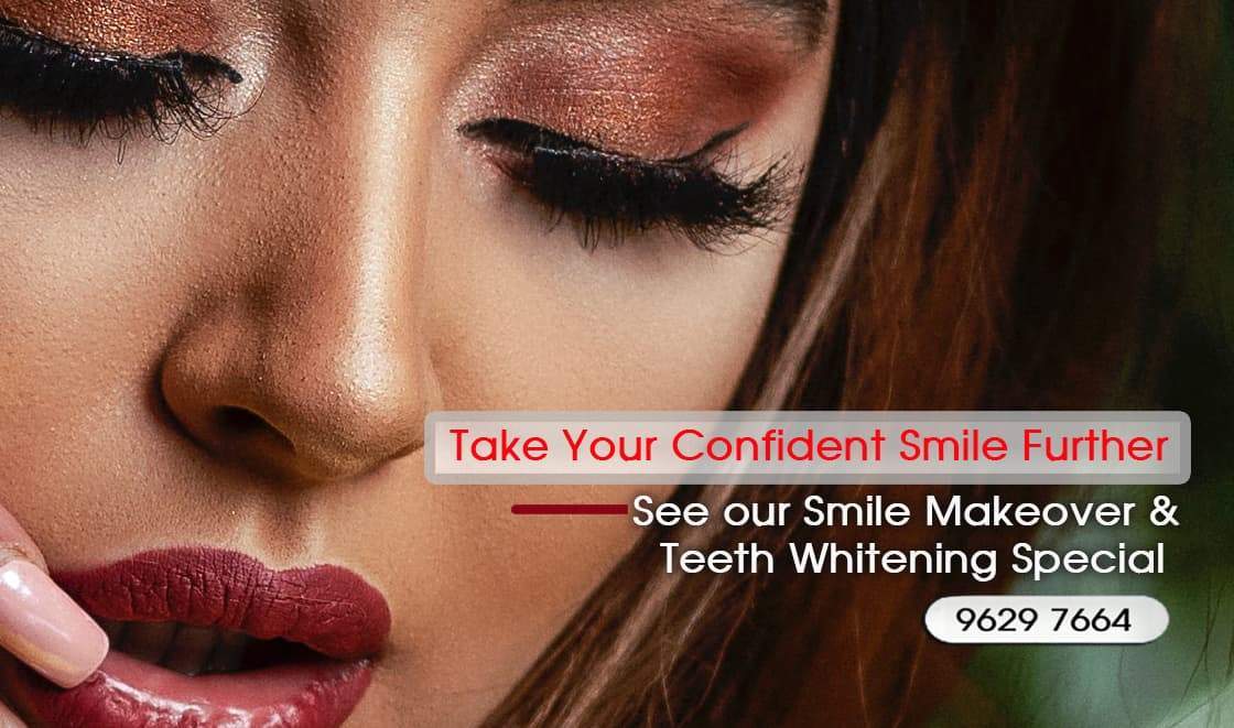 Best Teeth Whitening treatment in Melbourne -Best Teeth Whitening Clinics in Melbourne