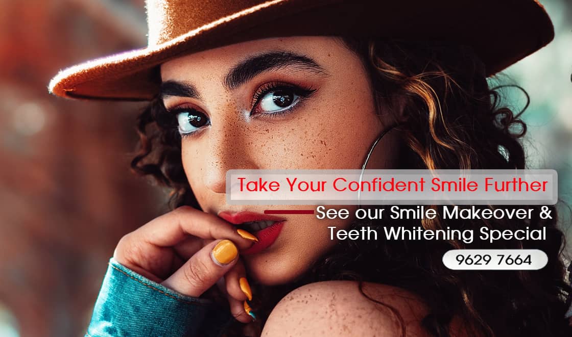 SMILE MAKEOVER PROCEDURES AND TREATMENT -Smile Makeover Melbourne, Teeth Transformation - Improve Smile Melbourne CBD Victoria Australia