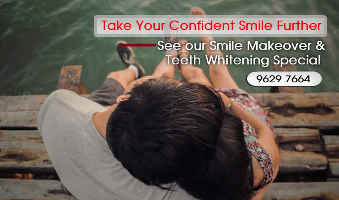 At-home Teeth Whitening Kits or Take-Home Whitening Melbourne CBD -affordable teeth whitening in Melbourne