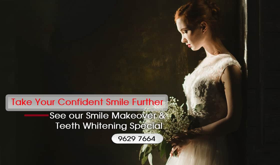 Wedding Smile Makeover Specials and Packages in Melbourne