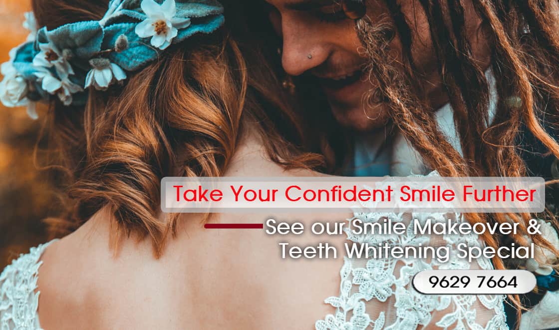 Best Laser Teeth Whitening in Melbourne with our Sapphire Laser System