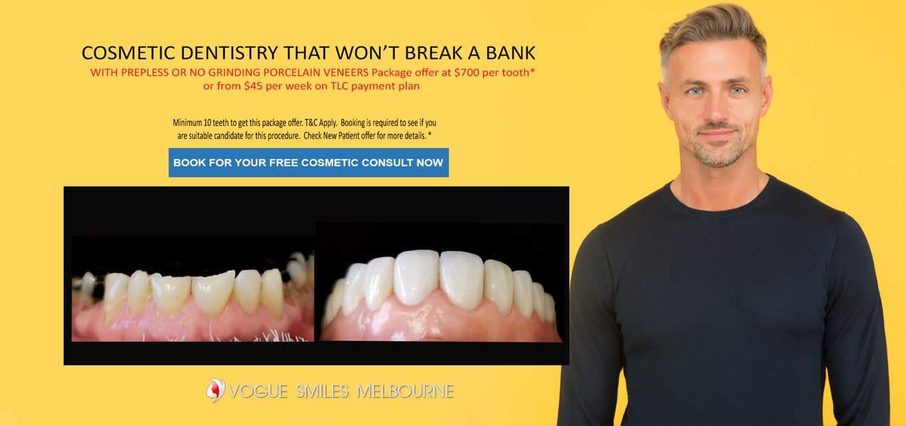 Smile Makeover Melbourne Cosmetic DENTIST