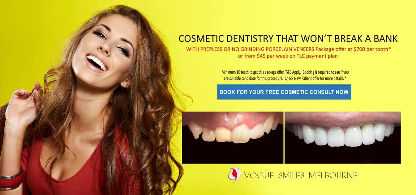 Same Day - One Visit New Smile with Composite Veneers Melbourne Cosmetic Dentist Dental Bonding