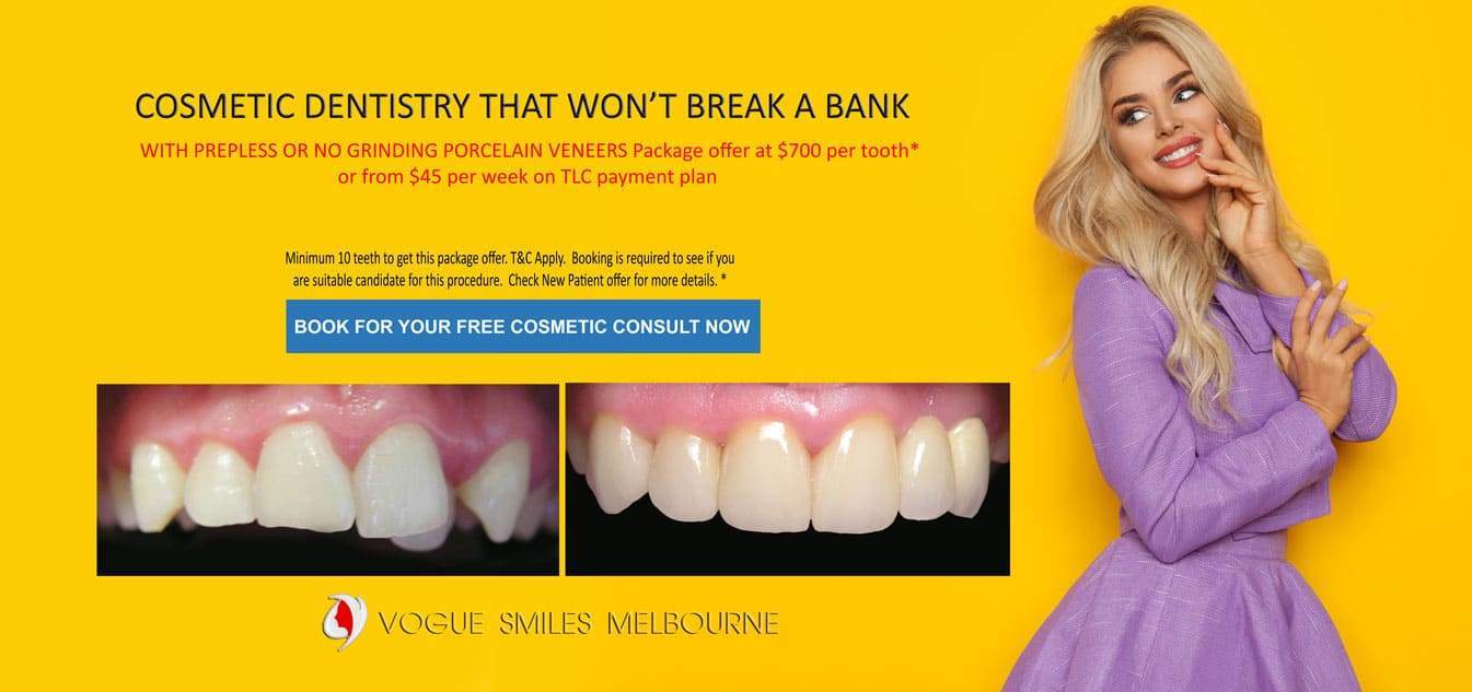 Invisible Braces Melbourne- Clear Aligners Melbourne - Invisalign Melbourne CBD City 3000 Victoria Australia