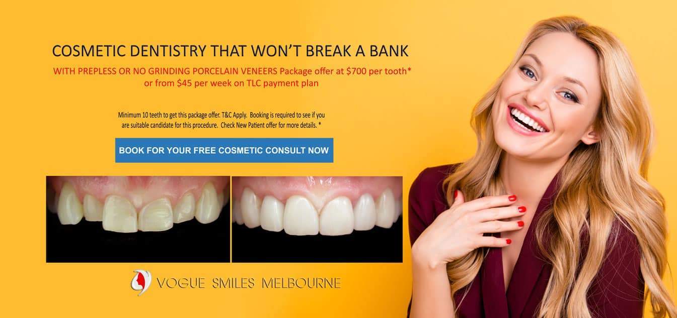 Replace Silver fillings with White, Composite Fillings Melbourne CBD