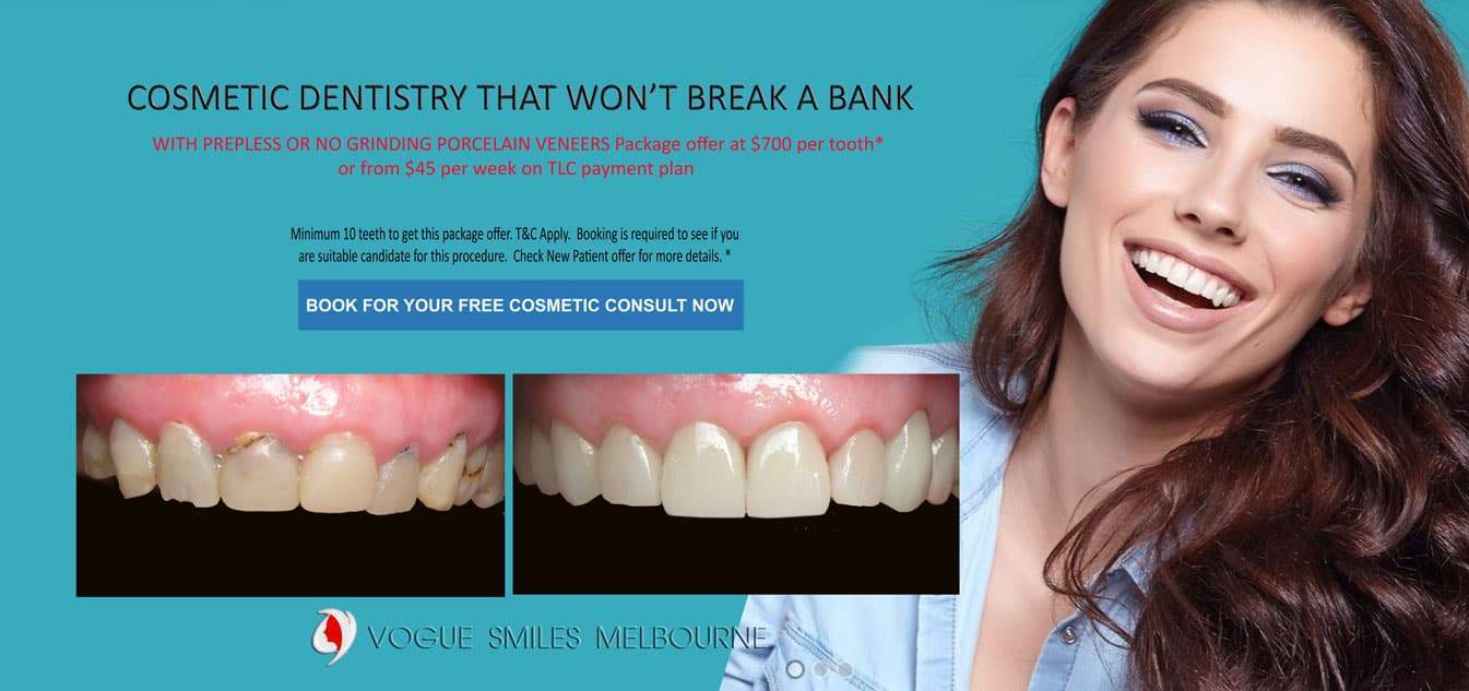 White Spots on Teeth and Enamel Defect Treatment Melbourne, Remove Tooth Discolouration Melbourne, Hypoplastic Teeth Melbourne CBD Victoria Australia