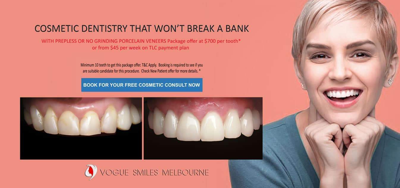 Composite Veneers versus Porcelain Veneers Melbourne CBD- best Cosmetic dentist in Melbourne CBD Victoria Australia