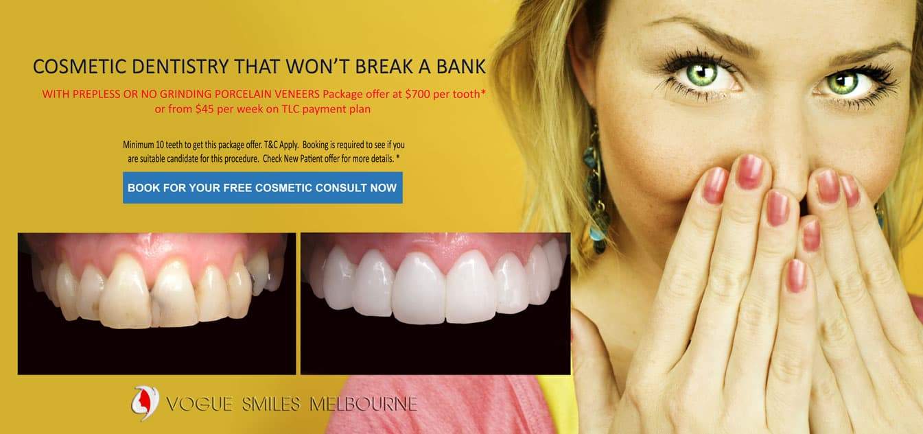 Affordable Cosmetic Dentistry with Composite Bonding Resin Veneers - Cosmetic Dentist Melbourne CBD