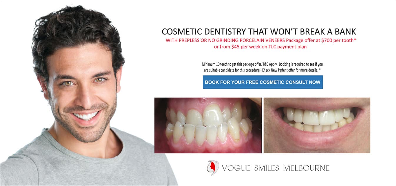 Dental Check-up and Teeth Cleaning Melbourne