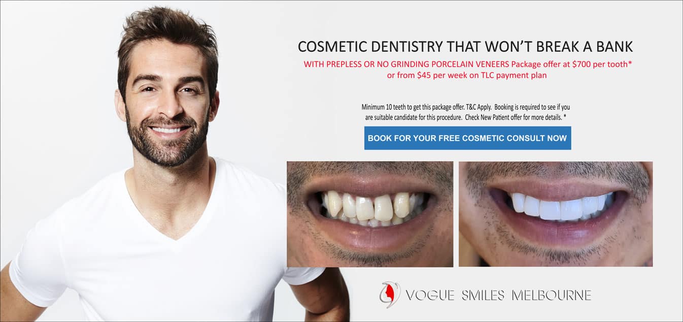 Instantly Straighten Crooked Teeth with Porcelain Veneers -Melbourne Cosmetic Dentist