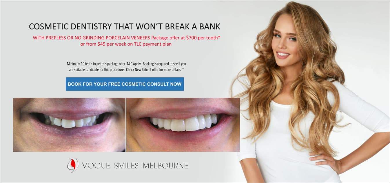 Lost tooth Filling treatment Repair Melbourne CBD, Filling Fell Out of Your Tooth, Filling Falls Out, tooth filling falls out, tooth filling fell out no pain, tooth filling fell out no pain,
