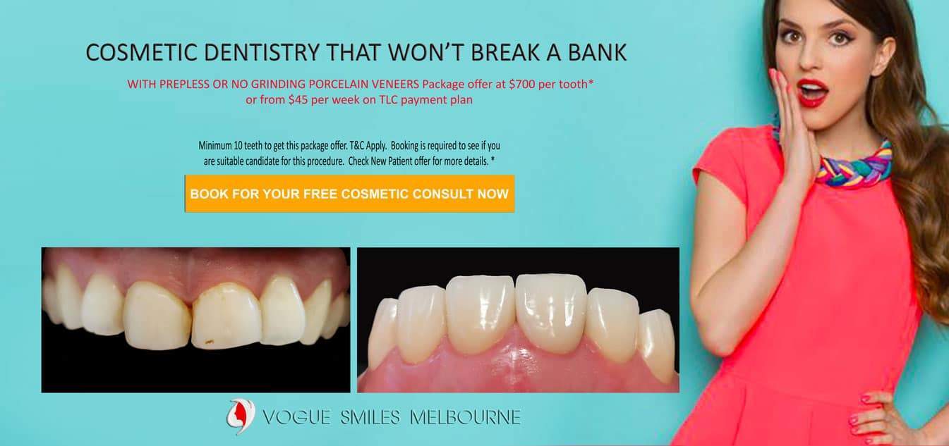 TRANSITIONAL SMILE MAKEOVER Melbourne CBD, Intermediate Cheapest most affordable Cosmetic Dentistry option to improve smile Melbourne Victoria Australia 