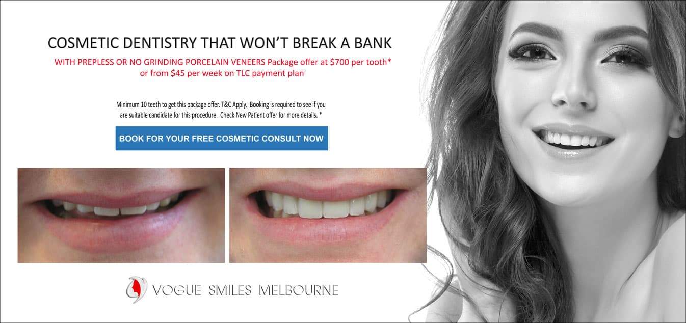 General Dentistry Melbourne Services - Best Dentist in Melbourne CBD - Best Dental Clinic in Melbourne CBD