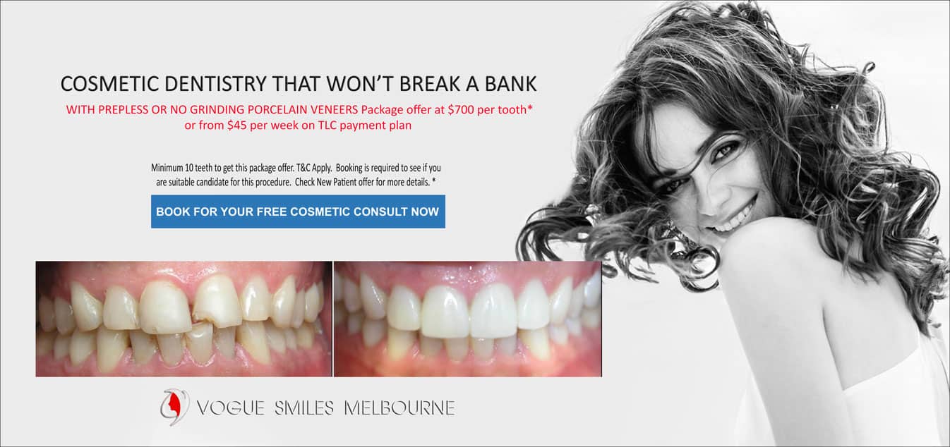 Chipped tooth Melbourne, Cracked tooth Melbourne & Broken Tooth treatment Melbourne CBD Dentist