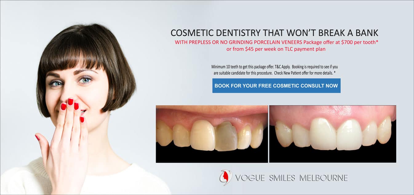 Cost of Full Sets of Porcelain Veneers Melbourne CBD