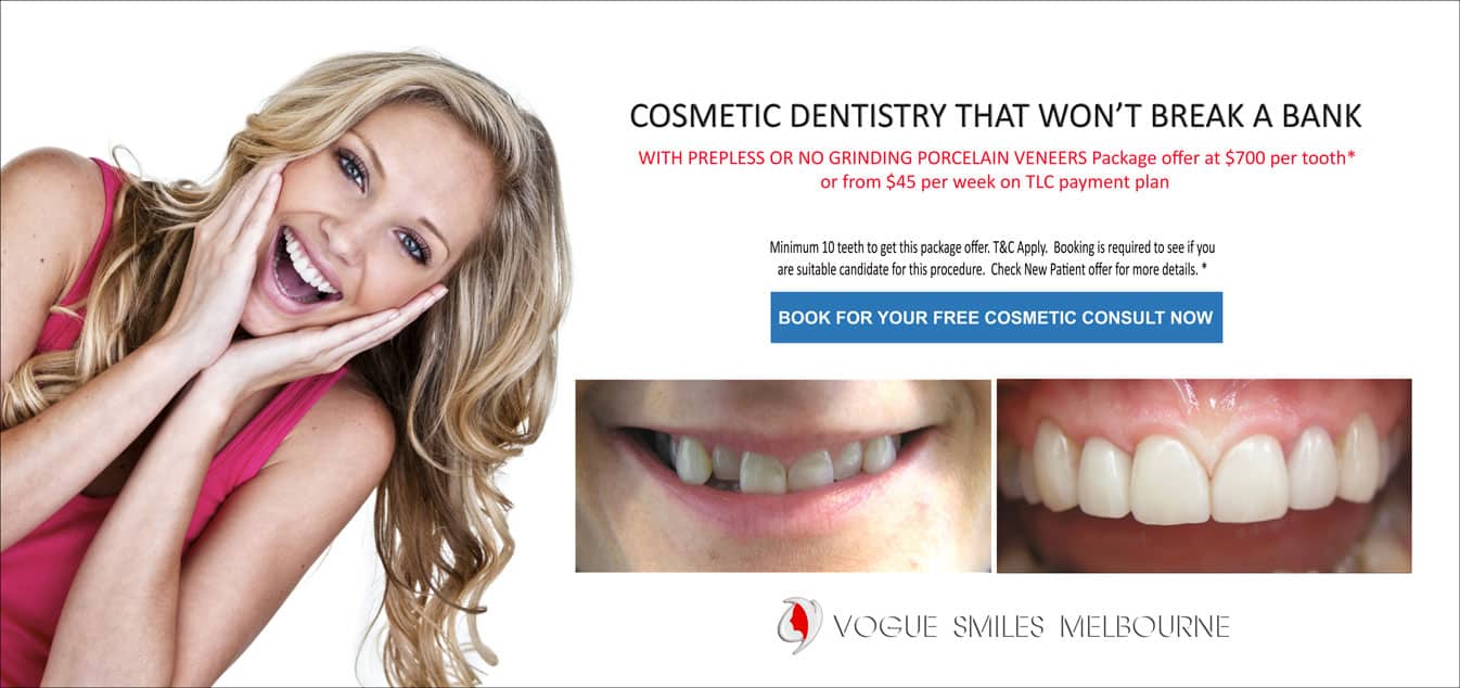 Composite Bonding for Crooked Teeth Melbourne CBD Cosmetic Dentist