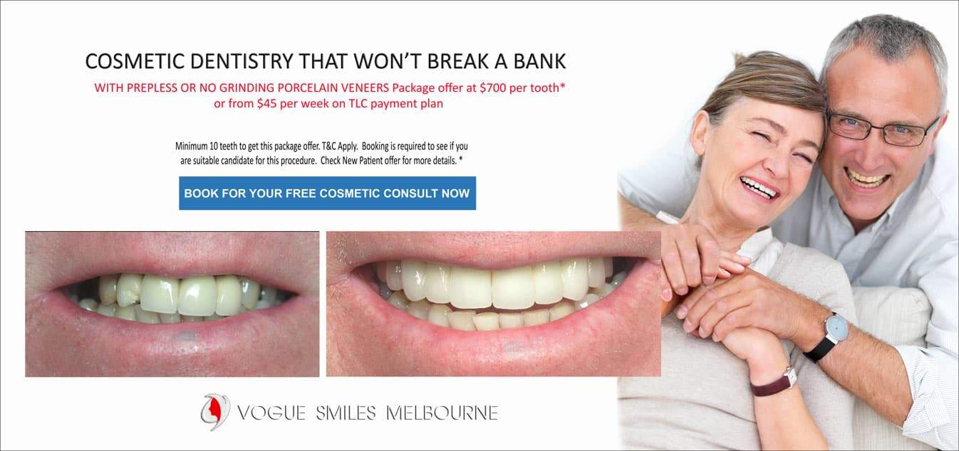 Replace Teeth Instantly Melbourne- Intermediate, Affordable Same Day Smile Makeover Solution, Melbourne CBD