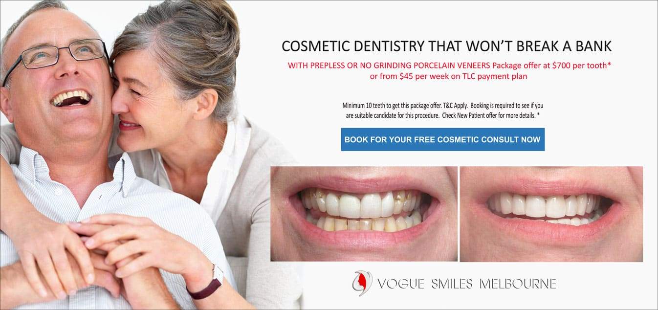 How Much Does Dental Crown cost in Melbourne, cost of dental crown in Melbourne, front tooth crown cost Dentist in Melbourne CBD, cheapest dental Crown in Melbourne