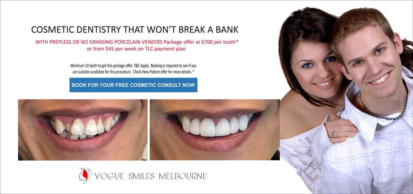 Composite Veneers Vs. Porcelain Veneers Melbourne CBD Victoria Australia - Cosmetic Dental Clinic Melbourne 