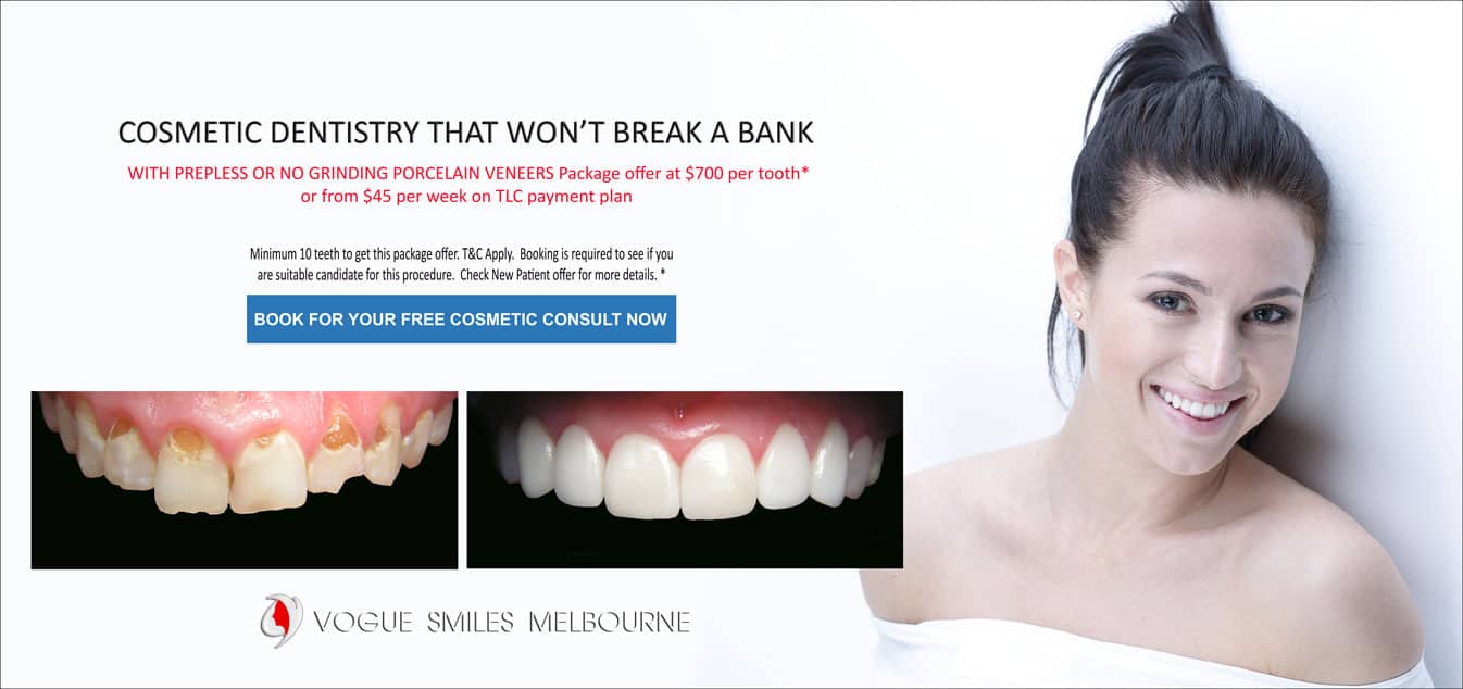 Permanent Teeth Whitening Treatment With Porcelain Veneers -COSMETIC DENTIST IN MELBOURNE CBD