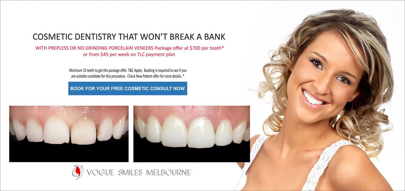 Porcelain veneers with No Grinding Down of Teeth Melbourne CBD -Cosmetic dentistry - smile makeover Melbourne CBD 